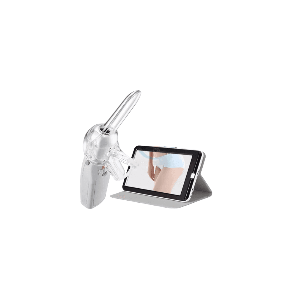 Digital Colposcope
